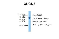 CLCN3 Antibody, Novus Biologicals 100 &mu;L; Unconjugated:Antibodies, Polyclonal